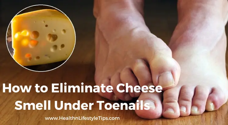 How To Eliminate Cheese Smell Under Toenails 3 Treatments 